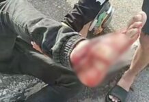 IMAGENS FORTES: Motociclista fica gravemente ferido após colisão na Bola do Jorge Teixeira, em Manaus