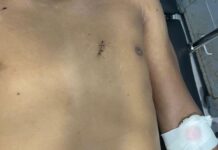 Jovem de 18 anos morre após ser esfaqueado em embarcação que vinha do Peru para o AM