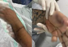 Motorista de aplicativo tem dedo amputado após ser atacado com terçado em Manaus