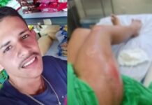 Ex-marido é suspeito de tentar matar adolescente atropelada por caminhão em Coari