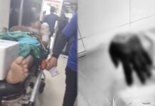Agricultor tem mão decepada em ataque brutal no interior do AM
