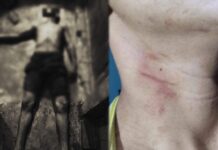 Mulher é presa após matar companheiro a facada durante briga em Parintins