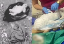 RECÉM-NASCIDA RESGATADA EM LIXEIRA NÃO RESISTE E MORRE NO HOSPITAL EM MANACAPURU