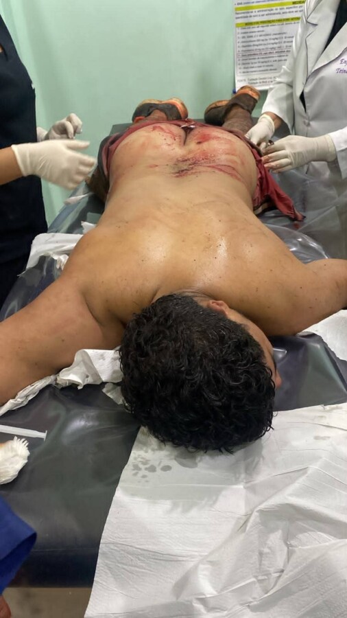 Policiais do Tático Móvel durante ocorrência que terminou com suspeito baleado e preso por tráfico de drogas em Iranduba.
